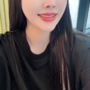 투디치과 무삭제 라미네이트 블랙필름 후기 +한달사용후기 (옥니개선)