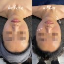 상봉빌딩 | [리뷰/후기] 상봉에스테틱 신부관리 에스테티아 망우역점 윤곽관리 찐후기