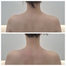 부천에스테틱 밸런스 등관리 눈이 부시게 스킨앤바디