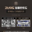 바라던 치과기공소 이미지