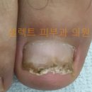 셀렉트피부과의원 네이버블로그