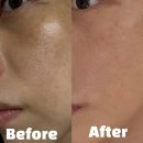 더맑은스킨천안불당점 | 천안 피부 천안 에스테틱 전문 관리샵 불당동 스킨케어 더맑은스킨 천안불당점 잡티관리후기