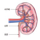 만성 신부전증 이란 이미지