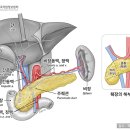 췌장암 - Pencreas cancer 이미지