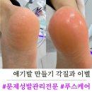 부산 남구 발각질제거 1:1맞춤 관리 푸스케어 부산광안리W스퀘어점 솔직 후기