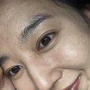 주근깨