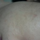 세라케어 이미지