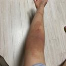 9 | 시너지원팩 프로알지9 효과 후기