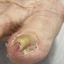 부천디에고푸스본점어딕션네일&풋케어전문 이미지