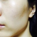 화장 후 좁쌀여드름 처치하기 / 얼라이브랩 센텔라드레싱파우더 후기 / 센텔라 아시아티코사이드...