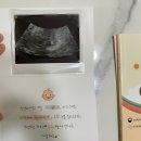 세종전동청안물류 | [시험관 기록] 4일배양 신선 1차 후기 5 - 아기집 초음파, 서프라이즈 쉽지않네, 임밍아웃카드, 임신...