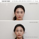 르수플