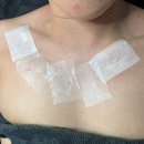 세기메디칼 | 대구가드름·대구등드름 관리 후기｜대봉동웨딩관리｜솔에스테틱 대구점