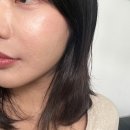 아라메길(4) 짧은 노선 | 구로 멜라리티 시술 10일 후기 :한번의 시술로 주근깨 기미 잡티 없애기: 브와브로우