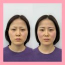 디자인 | 신사 눈썹 문신 디자인 잘하는 곳 실제 만족 후기