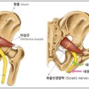 리메디PT 이미지