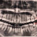 일산진사랑니치과의원 이미지