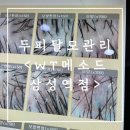 [후기] WT메소드삼성점 :: 두피관리 모발케어 지점 추천