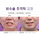 송정치과의원 네이버블로그