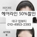 라인 업 뷰티 | 대구 헤어라인문신, 업뷰티 1회차 감탄 리얼후기