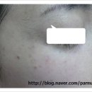 아이알(IR) 이미지
