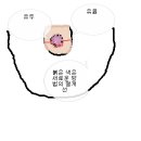 [한방성형][한방가슴성형][한방유방확대] 유방확대술-양방의 시술 이미지