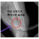 산본동물병원 | 산본동물병원, 슬개골 수술 잘하는 곳? &#39;이 2가지&#39;를 반드시 확인하세요