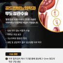 영등포비뇨기과 남성 정관수술 치료 유형 정보 공유