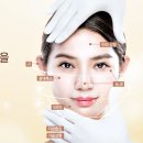 양승돈성형외과의원 티스토리