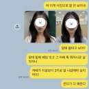 서른;두달 | 강남 온다리프팅 8만줄 가격 심부볼 리프팅에 효과 좋았던 시술 후기