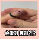 손과바늘 이미지