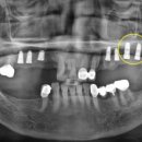 이승훈치과의원 이미지