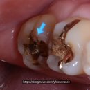 연희세브란스치과의원 이미지