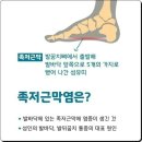 👣 아침에 더 심해지는 발뒤꿈치 통증, 족저근막염 이미지