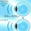 안경에 반하다 이미지