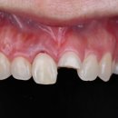 보람치과기공소 이미지