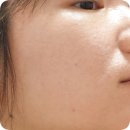 김종서성형외과의원 네이버블로그