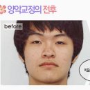 송파연세치과의원 네이버블로그