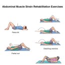 Abdominal Muscle Strain RE 이미지