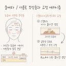 예지미피부과의원 | 울쎄라·더블로 후 오히려 얼굴이 처졌다면? 그 원인과 교정 방법까지 알아보기. MH클리닉