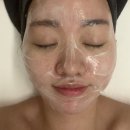 [순천 피부관리_조례호수공원 신부관리 찐추천] 순천 법원근처 여드름관리 마사지🤍(3회차)