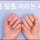 손톱과 발톱은 같은 속도로 자랄까? 손톱 발톱 자라는 속도 상식 이미지