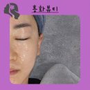 지에스(GS)25 대구동촌점 | 대구에스테틱 홍화뷰티 동촌유원지 메디컬 스킨케어 기미관리