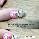 작은손톱 이미지