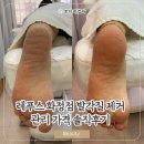 레푸스 화정점 | 레푸스 화정점 발 각질 제거 관리 가격 솔직후기