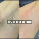 두피에서네일까지