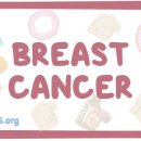 (주)고려바이오켐 | 유방암(breast cancer)개요