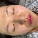 튀는아이들 | [서울 바이아이뷰티] 건대 성수 기미 잡티 제거 맛집 (후기 및 샵 소개, 예약 등)