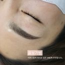 4u뷰티살롱 | 울산 눈썹잔흔제거 붉은기는 왜 생길까? 어떻게 해야 할까?