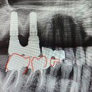 청담수치과의원 이미지